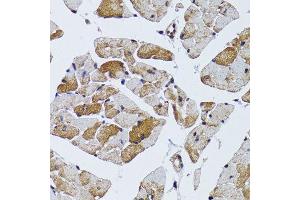 Immunohistochemistry of paraffin-embedded mouse heart using MRPS6 antibody (ABIN6003616) at dilution of 1/100 (40x lens). (MRPS6 Antikörper)