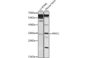 Western blot analysis of extracts of various cell lines, using PRRT2 antibody (ABIN7269559) at 1:1000 dilution. (PRRT2 Antikörper  (AA 20-130))