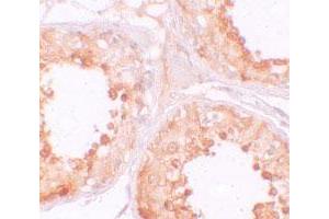 Immunohistochemical staining of human testis cells with YBX2 polyclonal antibody  at 10 ug/mL. (YBX2 Antikörper  (C-Term))