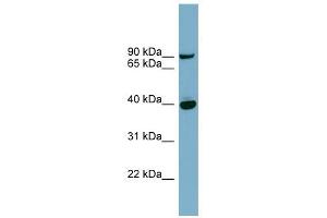 PNPLA8 antibody used at 1 ug/ml to detect target protein.