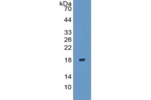 Rabbit Capture antibody from the kit in WB with Positive Control: Sample Human Testis lysate. (IL-17 CLIA Kit)