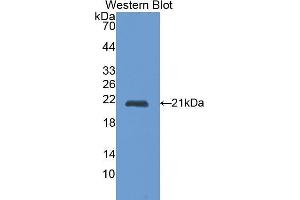Western Blotting (WB) image for anti-Cathepsin L1 (CTSL1) (AA 114-288) antibody (ABIN1172740) (Cathepsin L Antikörper  (AA 114-288))