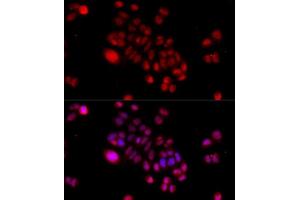 Immunofluorescence (IF) image for anti-DnaJ (Hsp40) Homolog, Subfamily B, Member 6 (DNAJB6) (AA 177-326) antibody (ABIN6139713)