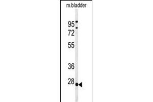 Western blot analysis of TPRGL Antibody (N-term) (ABIN651274 and ABIN2840164) in mouse bladder tissue lysates (35 μg/lane). (TPRG1L Antikörper  (N-Term))