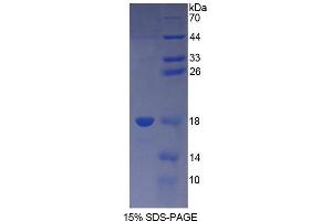 SDS-PAGE analysis of Human TSLP Protein. (Thymic Stromal Lymphopoietin Protein (TSLP))