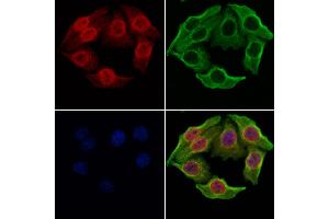 ABIN6264918 and ABIN6277937 staining Hela cells by IF/ICC. (SALL4 Antikörper  (Internal Region))