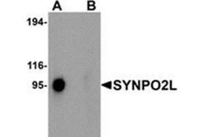 Western blot analysis of SYNPO2L in human thymus tissue lysate with SYNPO2L antibody at 1 μg/ml in (A) the absence and (B) the presence of blocking peptide.