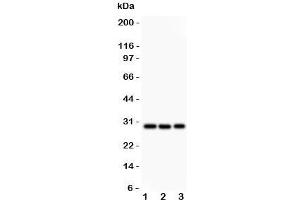 Western blot testing of CSEN antibody and Lane 1:  HeLa;  2: U87;  3: SHG-44 lysate. (DREAM Antikörper  (N-Term))
