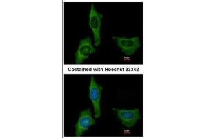 ICC/IF Image Immunofluorescence analysis of methanol-fixed HeLa, using Factor X, antibody at 1:200 dilution. (Coagulation Factor X Antikörper)