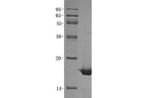 Western Blotting (WB) image for Acid Phosphatase 1, Soluble (ACP1) (Transcript Variant 3) protein (His tag) (ABIN2714335)