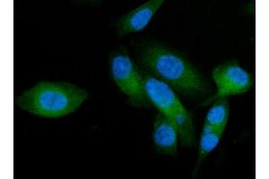 IF analysis of AP2A2 using anti-AP2A2 antibody (ABIN7602295).