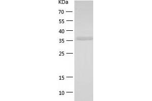Western Blotting (WB) image for serpin Peptidase Inhibitor, Clade B (Ovalbumin), Member 5 (SERPINB5) (AA 1-375) protein (His-IF2DI Tag) (ABIN7125051)