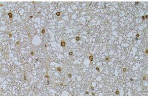 Immunohistochemistry of paraffin-embedded Rat spinal cord using HDGFRP3 Polyclonal Antibody at dilution of 1:100 (40x lens). (HDGFRP3 Antikörper)