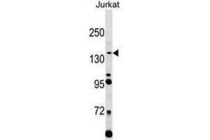 Western blot analysis in Jurkat cell line lysates (35ug/lane) using CD171 / L1CAM Antibody . (L1CAM Antikörper  (C-Term))
