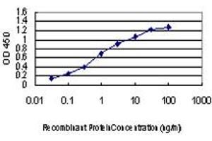 Detection limit for recombinant GST tagged IRAK2 is approximately 0. (IRAK2 Antikörper  (AA 111-210))