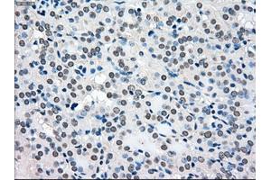Immunohistochemical staining of paraffin-embedded pancreas tissue using anti-BRAFmouse monoclonal antibody. (BRAF Antikörper)
