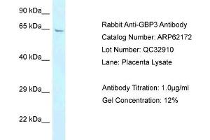 Western Blotting (WB) image for anti-Guanylate Binding Protein 3 (GBP3) (N-Term) antibody (ABIN2789048) (GBP3 Antikörper  (N-Term))