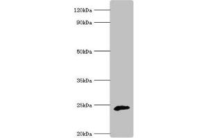 Western blot All lanes: Ubiquinone biosynthesis protein COQ7 homolog antibody at 6 μg/mL + Rat heart tissue Secondary Goat polyclonal to rabbit IgG at 1/10000 dilution Predicted band size: 25, 21 kDa Observed band size: 25 kDa (Coq7 Antikörper  (AA 37-217))
