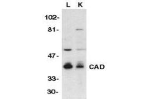 Western Blotting (WB) image for anti-DNA Fragmentation Factor, 40kDa, beta Polypeptide (Caspase-Activated DNase) (DFFB) (C-Term) antibody (ABIN499517)