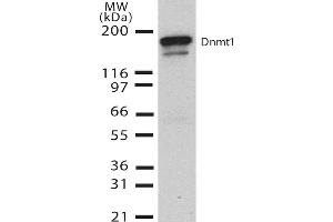 Western Blot analysis of Human H1299 cell lysate showing detection of DNMT1 protein using Mouse Anti-DNMT1 Monoclonal Antibody, Clone 60B1220. (DNMT1 Antikörper  (AA 637-650) (PE))
