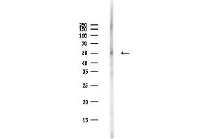 Western blot analysis of lysates from PC12 cells(starvation,24h treatment), using JNK3 Antibody at 1/1000 dilution.