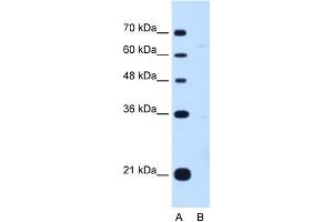 WB Suggested Anti-DONSON Antibody Titration:  0. (DONSON Antikörper  (Middle Region))