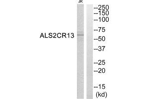 Western Blotting (WB) image for anti-Family with Sequence Similarity 117, Member B (FAM117B) (C-Term) antibody (ABIN1850761) (FAM117B Antikörper  (C-Term))