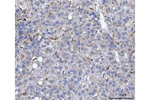 IHC analysis of Hsp47/SERPINH1 using anti-Hsp47/SERPINH1 antibody (ABIN3043331).