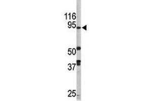 Western Blotting (WB) image for anti-Lysine (K)-Specific Demethylase 1A (KDM1A) (AA 108-142) antibody (ABIN3031651)