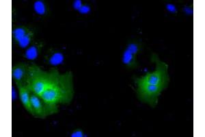 Image no. 9 for anti-Acetyl-CoA Acetyltransferase 2 (ACAT2) antibody (ABIN1496402) (ACAT2 Antikörper)