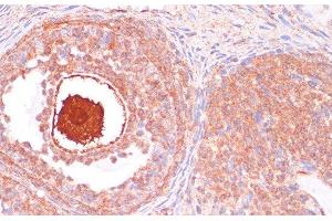 Immunohistochemistry of paraffin-embedded Rat ovary using CDC20 Polyclonal Antibody at dilution of 1:100 (40x lens). (CDC20 Antikörper)