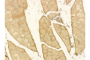 ST7 Mouse Monoclonal Antibody at 1/100 staining rat muscle tissue by IHC-P. (ST7 Antikörper)