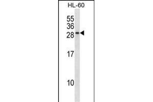 RAB15 Antibody (Center) (ABIN1537730 and ABIN2848465) western blot analysis in HL-60 cell line lysates (35 μg/lane).