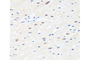 Immunohistochemistry of paraffin-embedded Rat heart using BRMS1 Polyclonal Antibody at dilution of 1:100 (40x lens). (BRMS1 Antikörper)