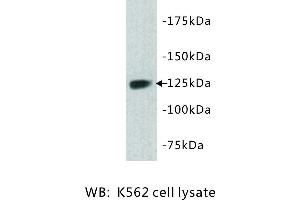 Image no. 1 for anti-tyrosine Kinase with Immunoglobulin-Like and EGF-Like Domains 1 (TIE1) antibody (ABIN1112934) (TIE1 Antikörper)