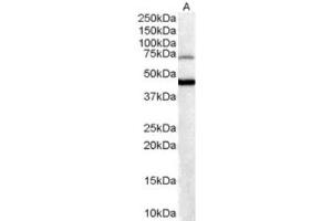 Western Blotting (WB) image for anti-Forkhead Box G1 (FOXG1) (C-Term) antibody (ABIN2465212) (FOXG1 Antikörper  (C-Term))