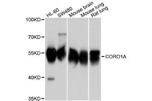 Western blot analysis of extracts of various cell lines, using CORO1A antibody. (Coronin 1a Antikörper  (AA 362-461))
