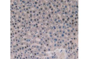 IHC-P analysis of liver tissue, with DAB staining. (Superoxide dismutase copper chaperone Antikörper  (AA 27-268))