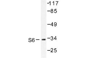 Image no. 1 for anti-Ribosomal Protein S6 (RPS6) antibody (ABIN272077) (RPS6 Antikörper)