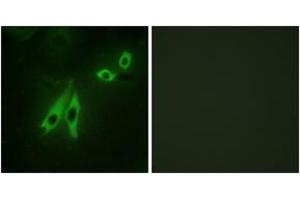 Immunofluorescence analysis of NIH-3T3 cells, using AKAP3 Antibody. (AKAP3 Antikörper  (AA 191-240))