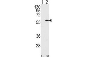 Western Blotting (WB) image for anti-Macrophage Stimulating 1 (Hepatocyte Growth Factor-Like) (MST1) antibody (ABIN3003576) (MST1 Antikörper)
