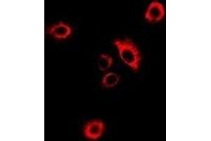 Immunofluorescent analysis of GlyRS staining in MCF7 cells. (GlyRS Antikörper)