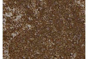 ABIN6261807 and ABIN6277494 at 1/100 staining Mouse spleen tissue by IHC-P.