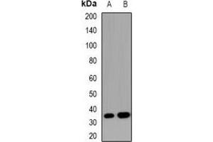 Western blot analysis of SOCS2 expression in HEK293T (A), Hela (B) whole cell lysates.