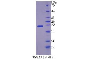 SDS-PAGE (SDS) image for Osteopetrosis Associated Transmembrane Protein 1 (OSTM1) (AA 124-277) protein (His tag) (ABIN6239191) (OSTM1 Protein (AA 124-277) (His tag))