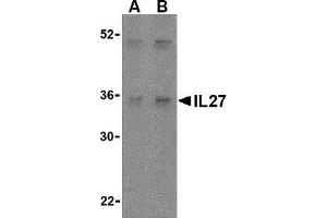 Western blot analysis of IL-27 in Daudi lysate with AP30421PU-N IL-27 antibody at (A) 2 and (B) 4 μg/ml. (IL27 Antikörper  (Center))