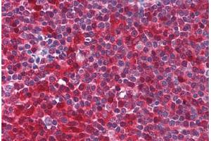 Human Tonsil (formalin-fixed, paraffin-embedded) stained with PYCARD antibody ABIN213971 at 5 ug/ml followed by biotinylated goat anti-rabbit IgG secondary antibody ABIN481713, alkaline phosphatase-streptavidin and chromogen. (PYCARD Antikörper  (AA 182-195))