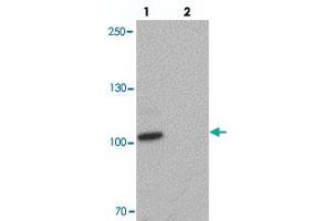 Western blot analysis of CCNT1 in rat brain tissue with CCNT1 polyclonal antibody  at 1 ug/mL in (lane 1) the absence and (lane 2) the presence of blocking peptide. (Cyclin T1 Antikörper  (C-Term))