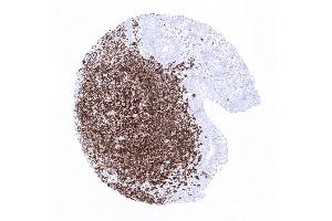 Immunohistochemistry (IHC) image for anti-Membrane-Spanning 4-Domains, Subfamily A, Member 1 (MS4A1) antibody (ABIN7477401)
