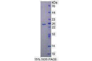 SDS-PAGE (SDS) image for Peroxiredoxin 4 (PRDX4) (AA 14-258) protein (His tag) (ABIN2121842) (Peroxiredoxin 4 Protein (PRDX4) (AA 14-258) (His tag))